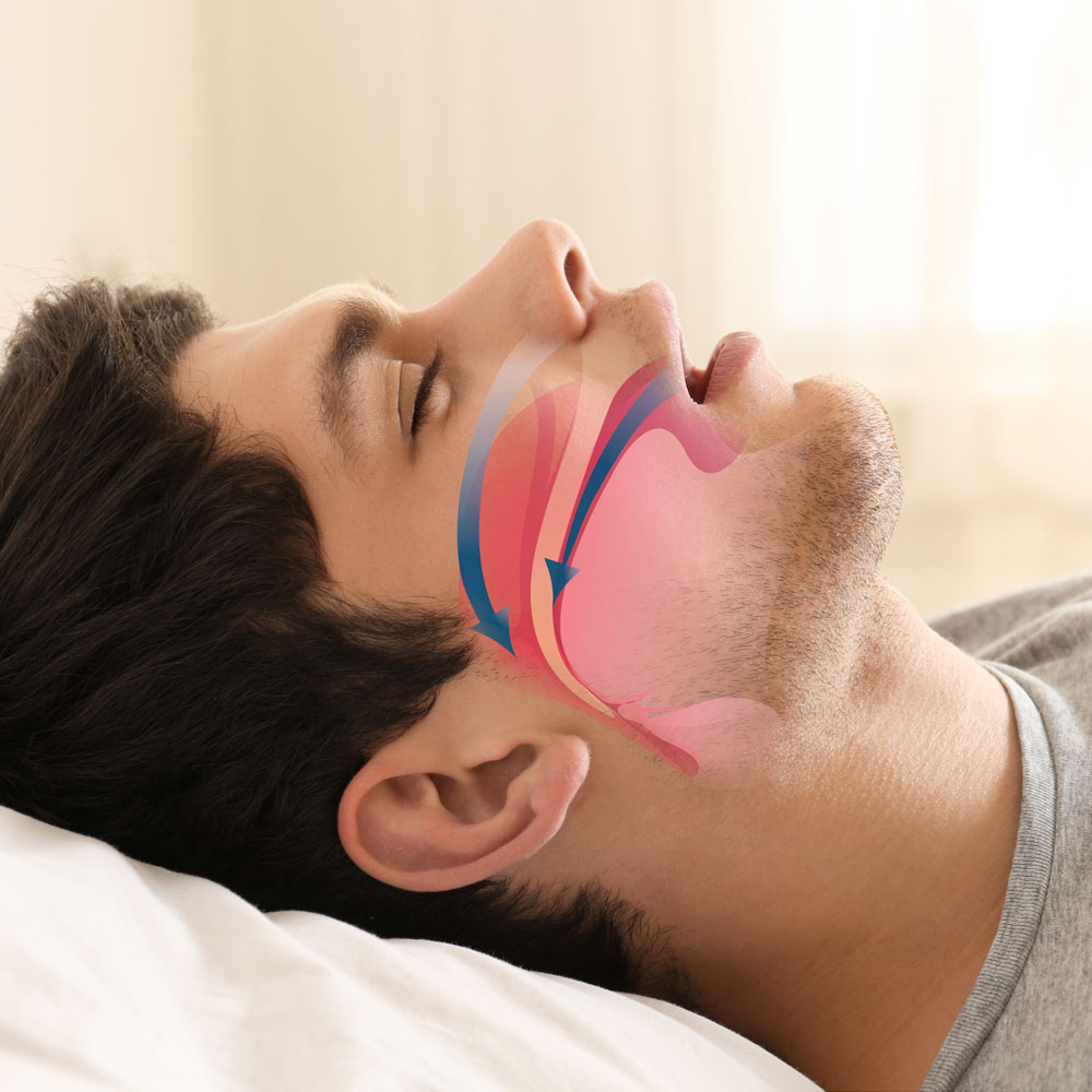 TMD & Sleep Apnoea Treatment — Root Canal & TMJ Care