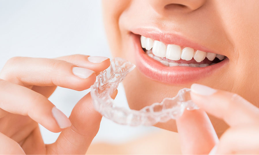 Clear Aligners treatment