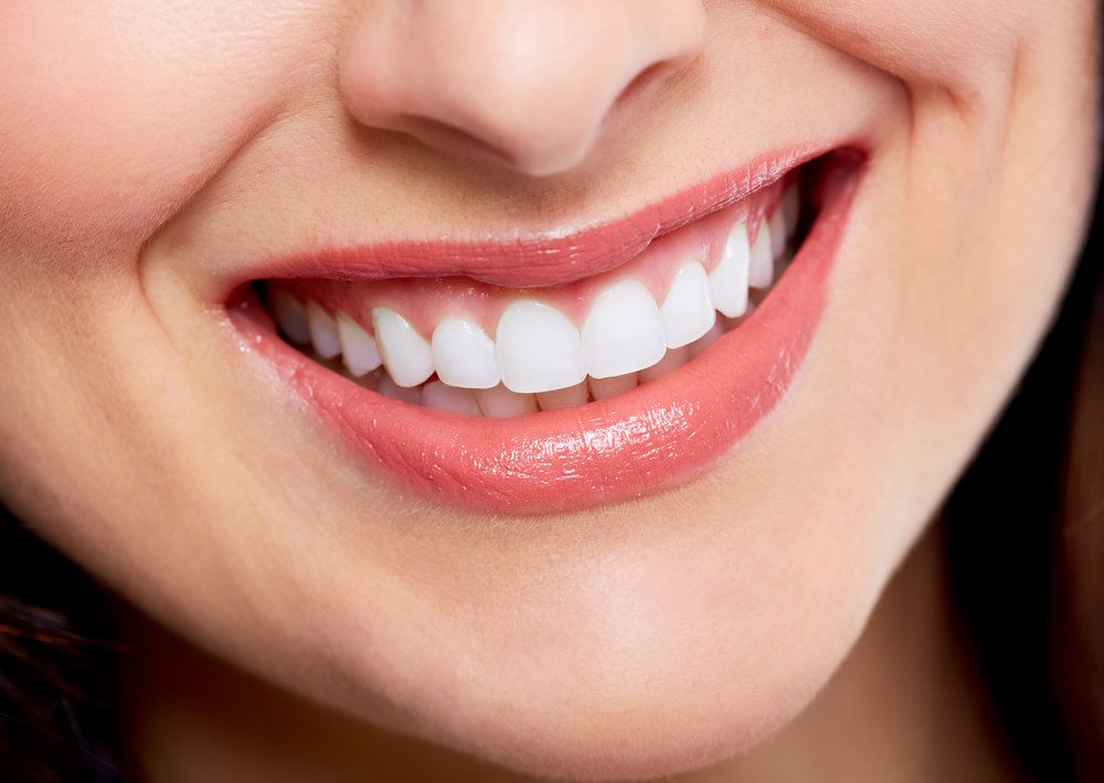 Smile Makeover treatment